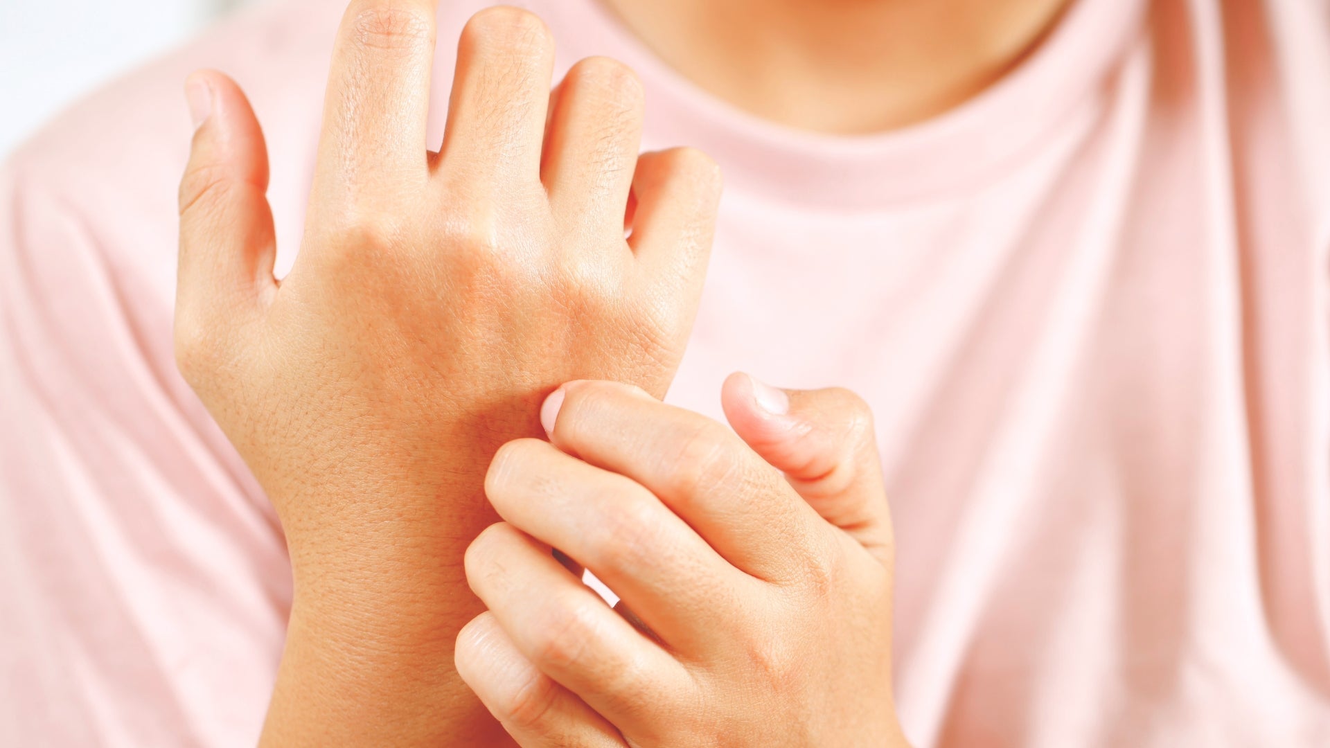 Atooppisen ihottuman hoito 2026: Miksi hellävarainen puhdistus on tärkein askel?