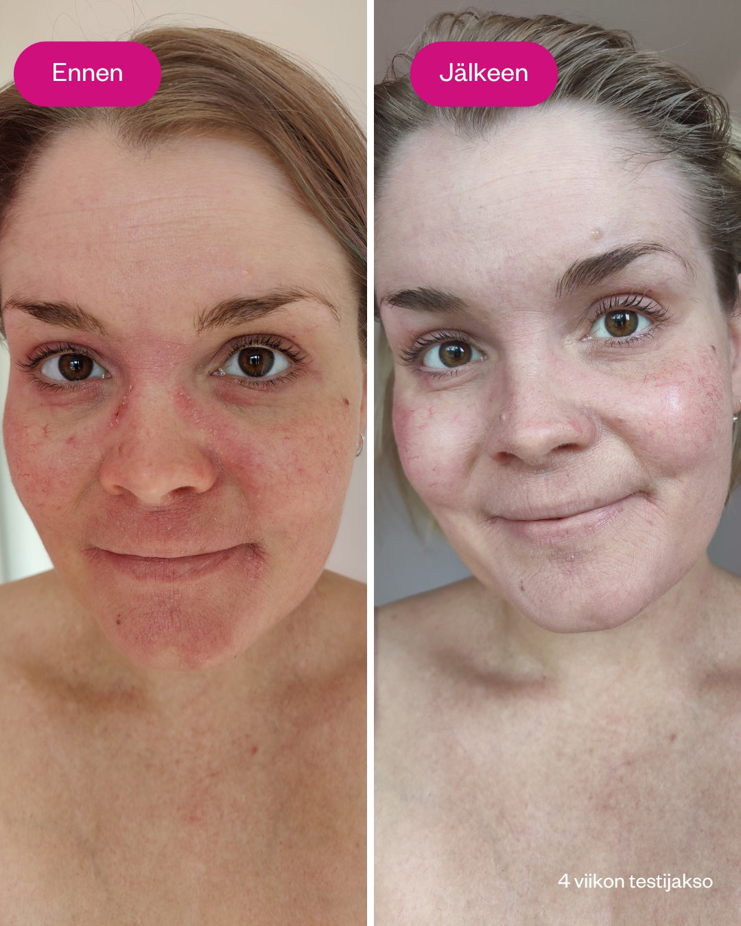 Ceramides & Probiotics Cream Cosmos Natural - korjaava herkän ihon kasvovoide (hajusteeton)