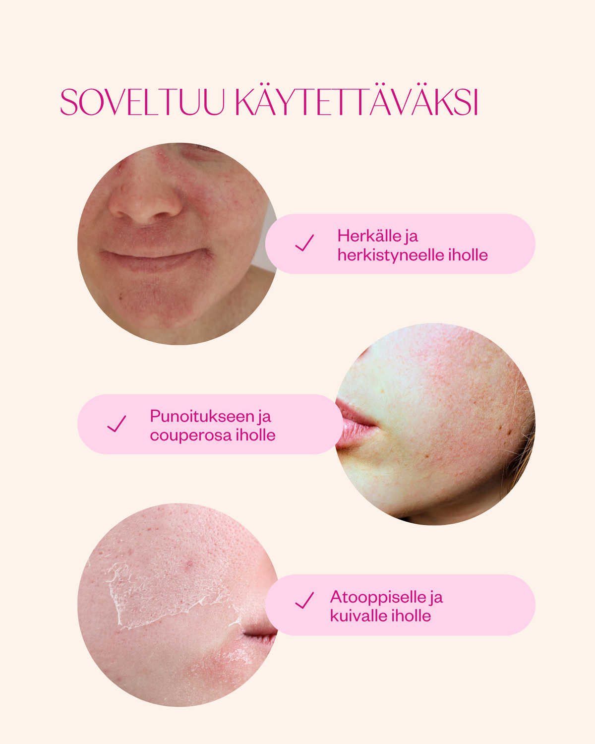Ceramides & Probiotics Cream - korjaava herkän ihon kasvovoide (hajusteeton)