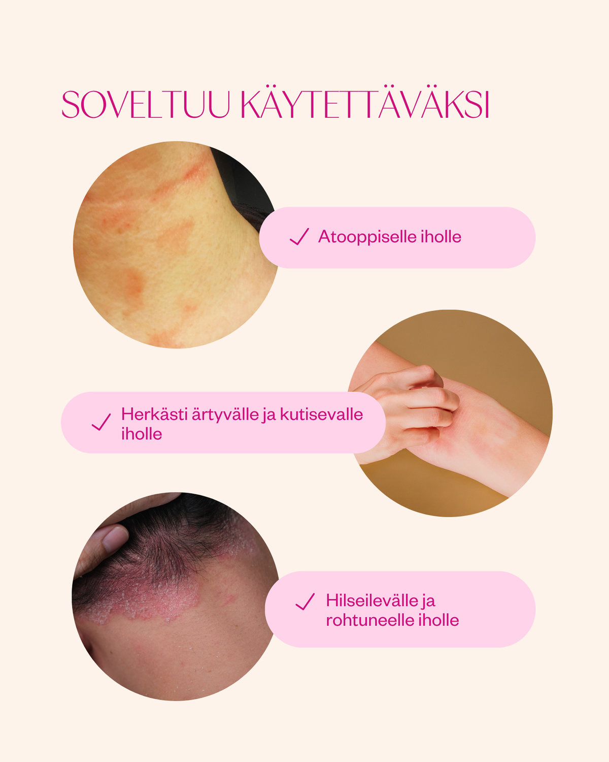 Propolis & Probiotics Rescue Cream erikoisvoide ongelmaiholle