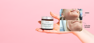 Flow Cosmetics Propolis & Probiotcs tehovoide atooppiselle iholle ja muihin iho-ongelmiin