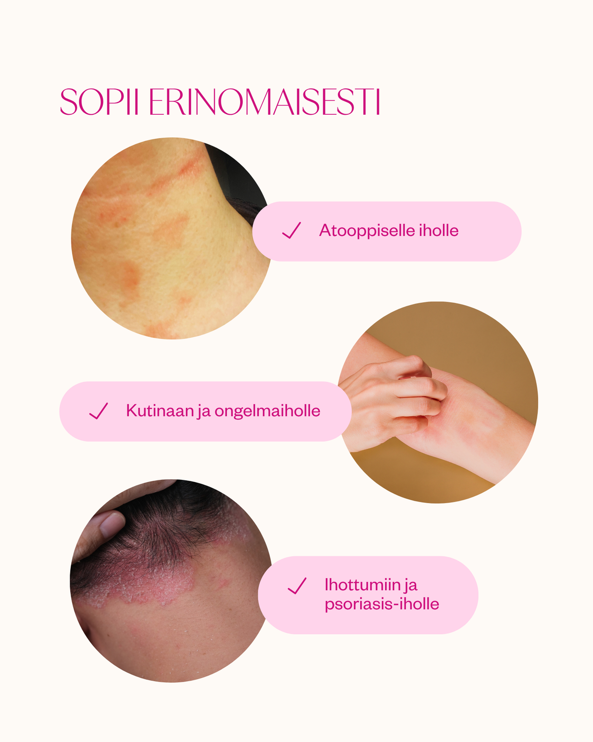 Atooppisen ihon starttipaketti