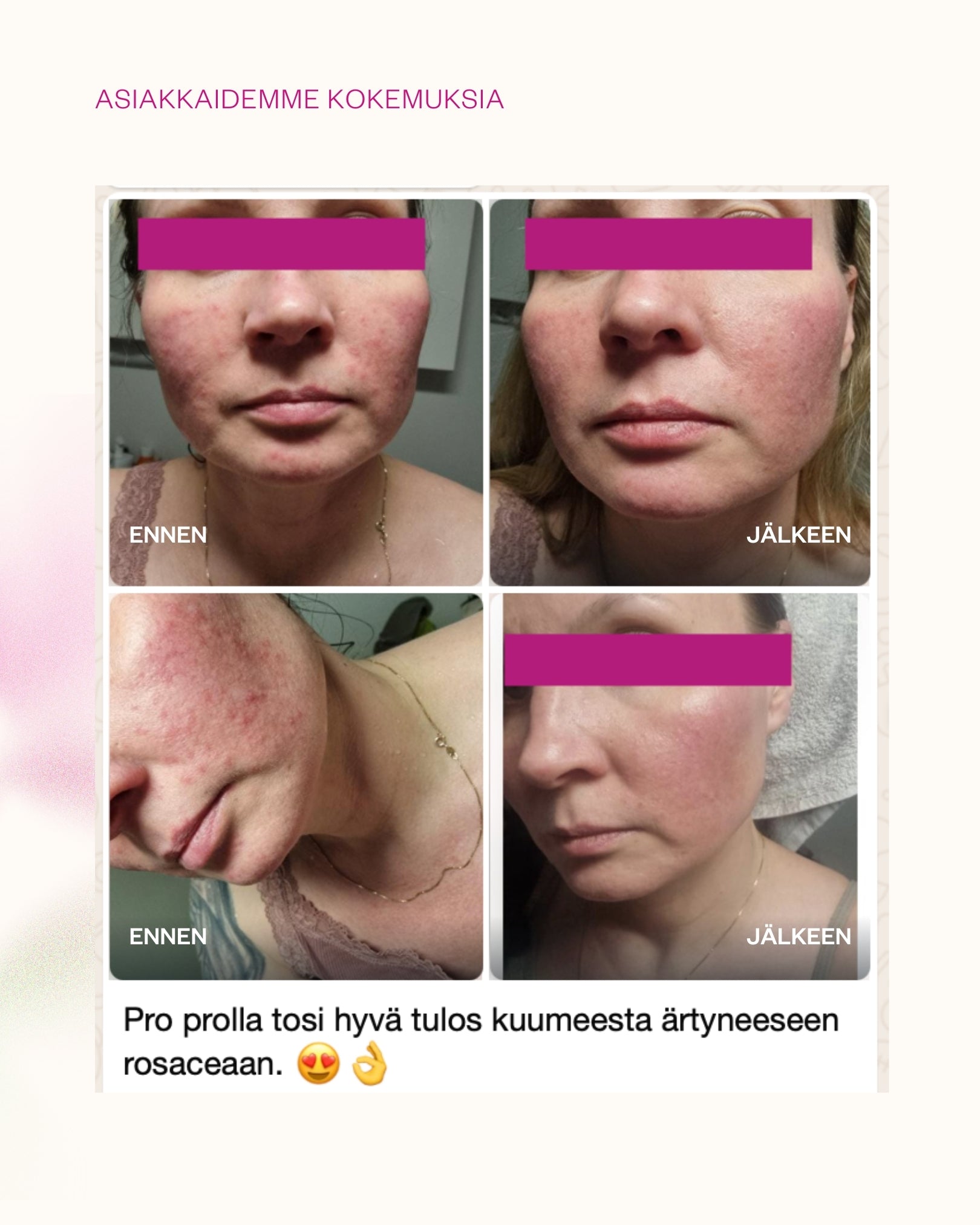 Propolis & Probiotics Rescue Cream erikoisvoide atooppiselle ja ongelmaiholle