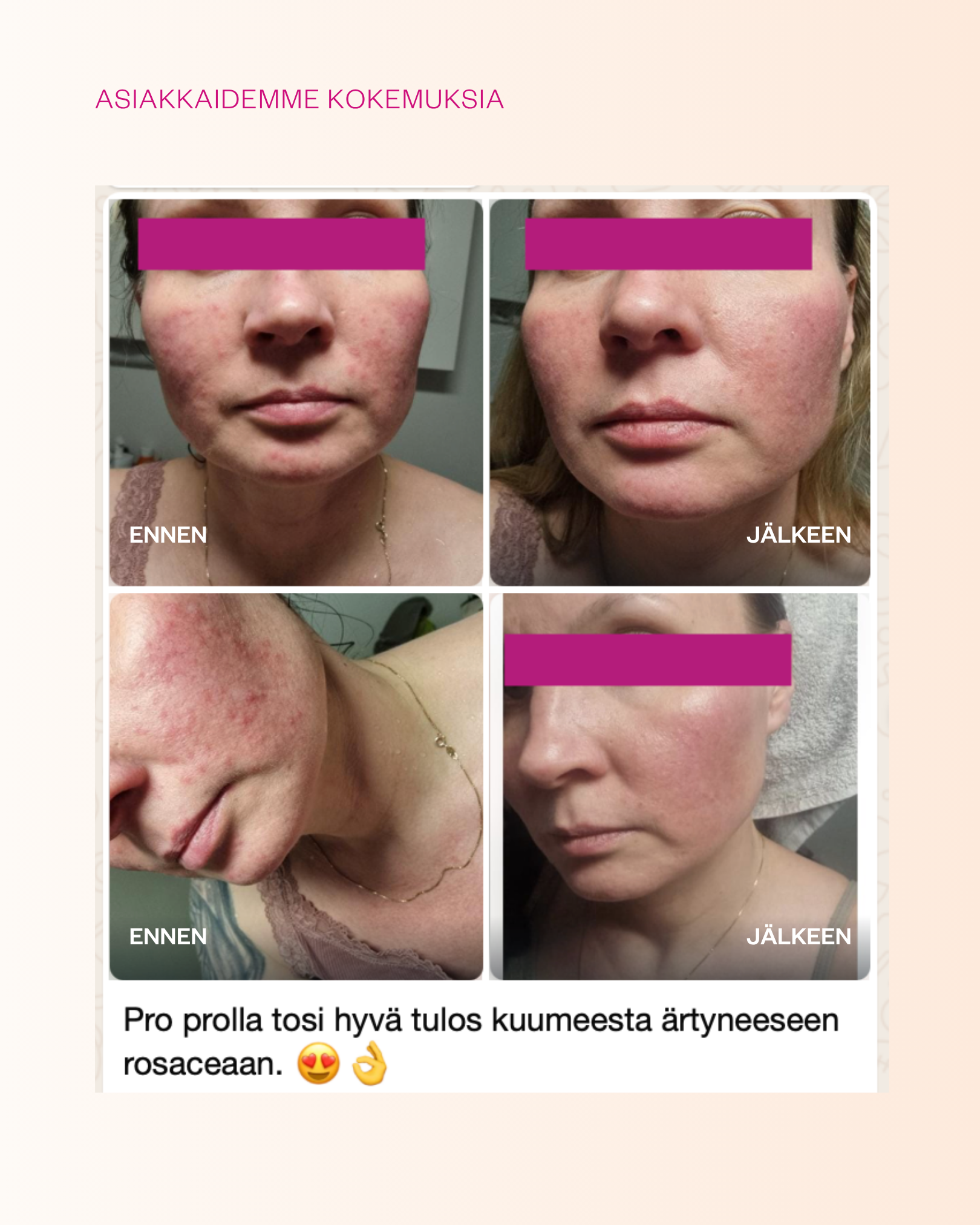 Propolis & Probiotics Rescue Cream erikoisvoide atooppiselle ja ongelmaiholle