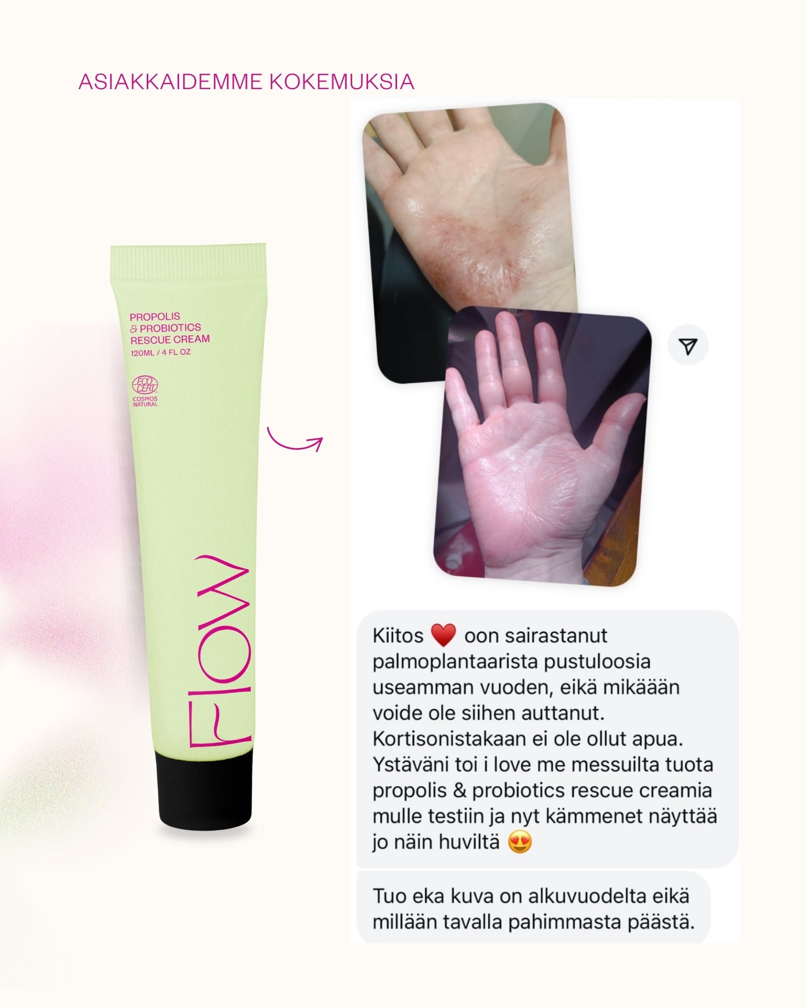 Propolis & Probiotics Rescue Cream erikoisvoide atooppiselle ja ongelmaiholle