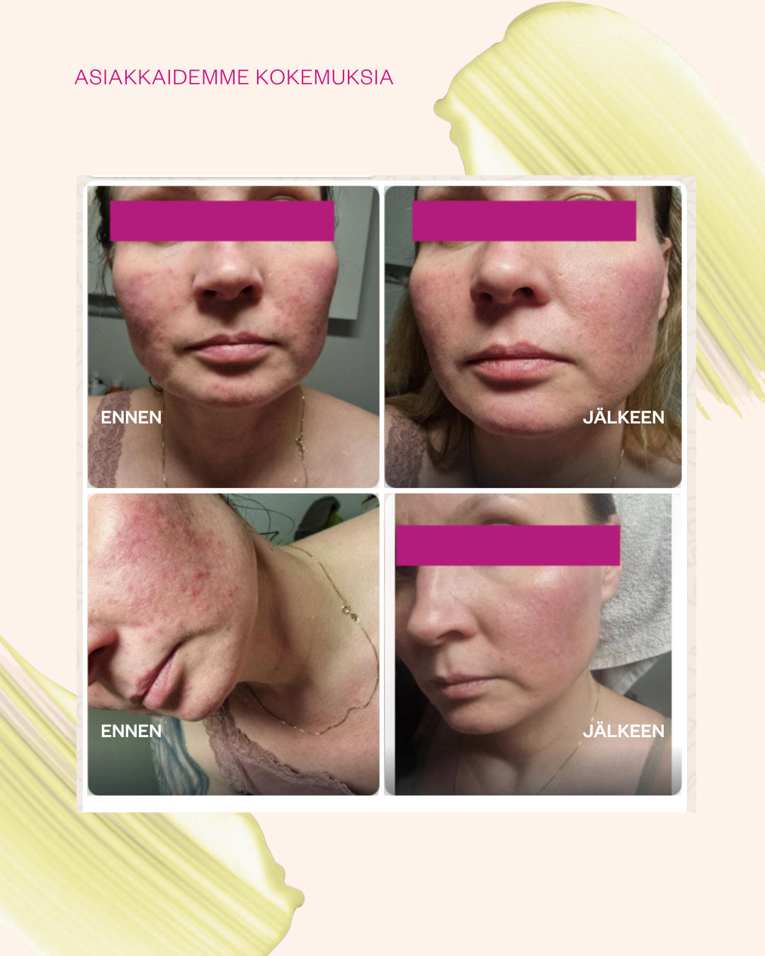 Propolis & Probiotics Rescue Cream matkakoko
