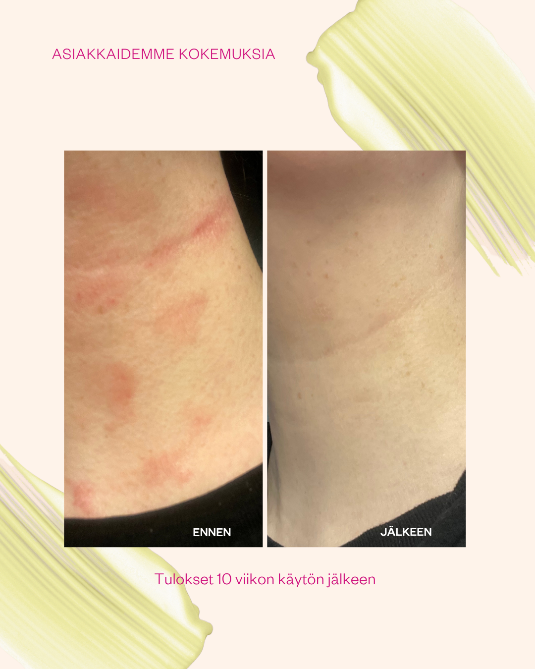 Propolis & Probiotics Rescue Cream matkakoko