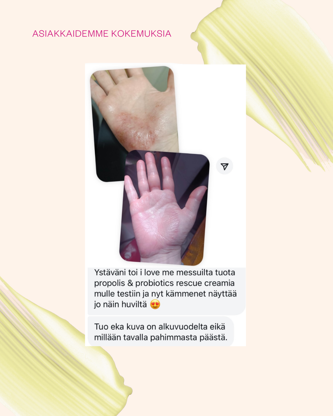 Propolis & Probiotics Rescue Cream matkakoko
